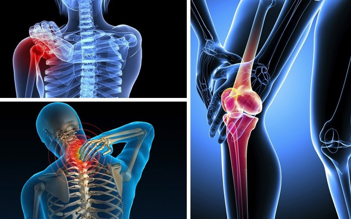 3 bài thuốc Đông y hỗ trợ cải thiện tình trạng đau nhức xương khớp